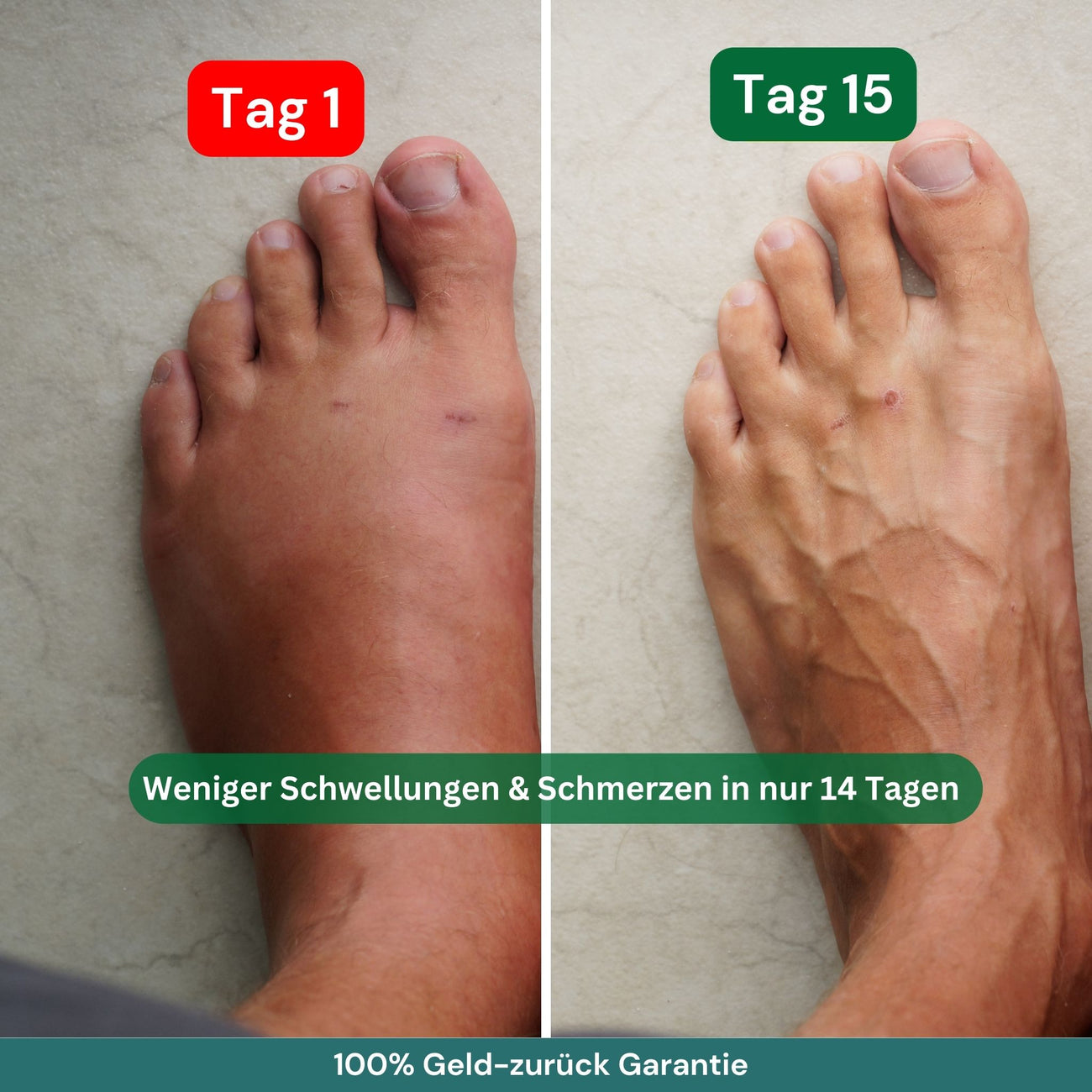 Kompressionsstrümpfe für Flüge, Alltag, schwere & schmerzende Beine