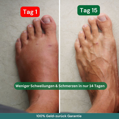 Kompressionsstrümpfe für Flüge, Alltag, schwere & schmerzende Beine