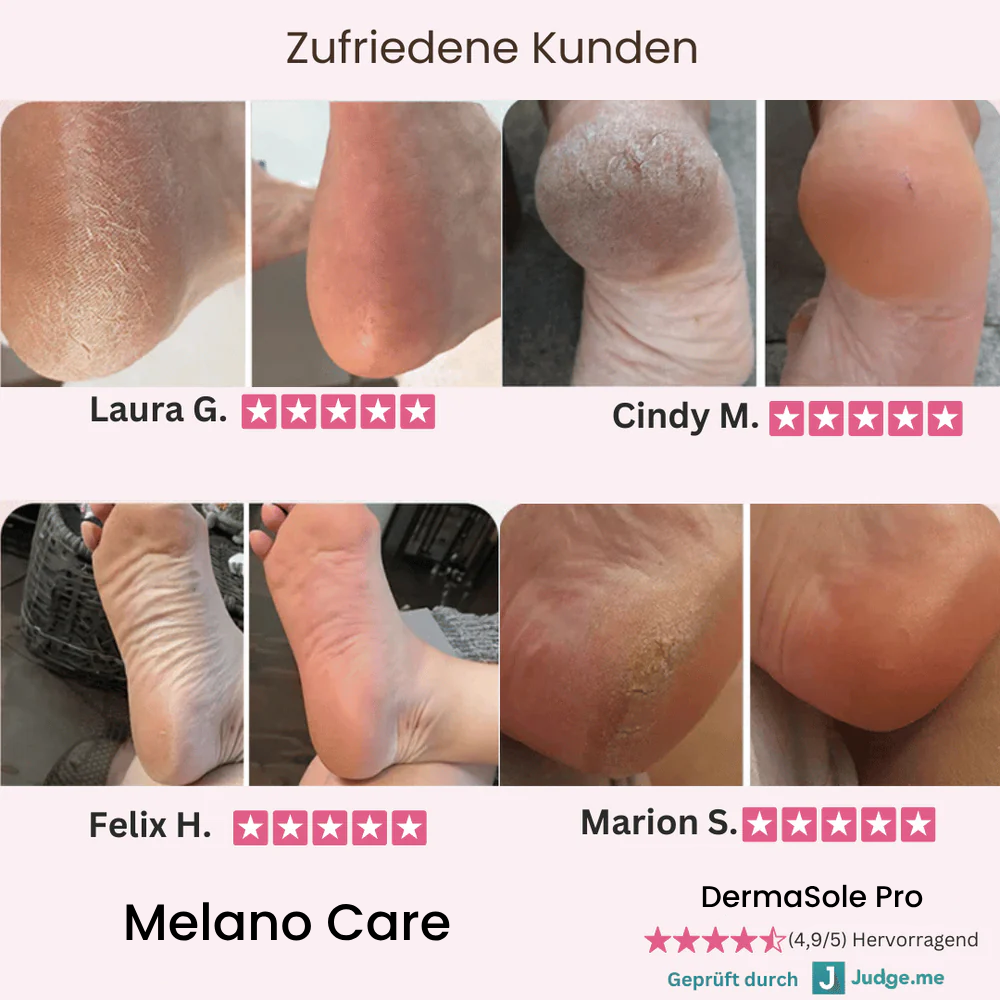 DermaGlide Pro inkl. 60 Glide Pads (Gratis)