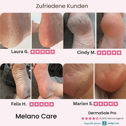 DermaGlide Pro inkl. 60 Glide Pads (Gratis)